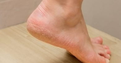 الجلد الميت